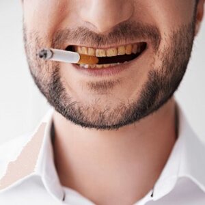 هل يستطيع المدخنون تبييض أسنانهم؟