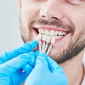 ماذا يحدث إذا حصلت على تجويف مع قشور