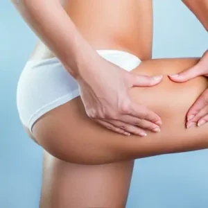 تكلفة علاج ازالة السيلوليت في دبي