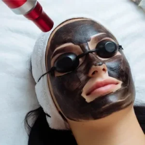 كم مرة يجب عليك الحصول على التقشير بالليزر الكربوني؟