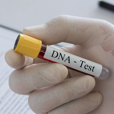 هل من الممكن أن يكون فحص الحمض النووي خاطئاً؟