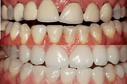 أفضل عيادة طب الأسنان التجميلي