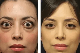 جراحة تصحيحية تجميلية