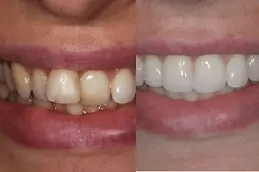 خدمات مقومات الأسنان الحديثة