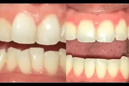 عيادة مقومات الأسنان المتقدمة