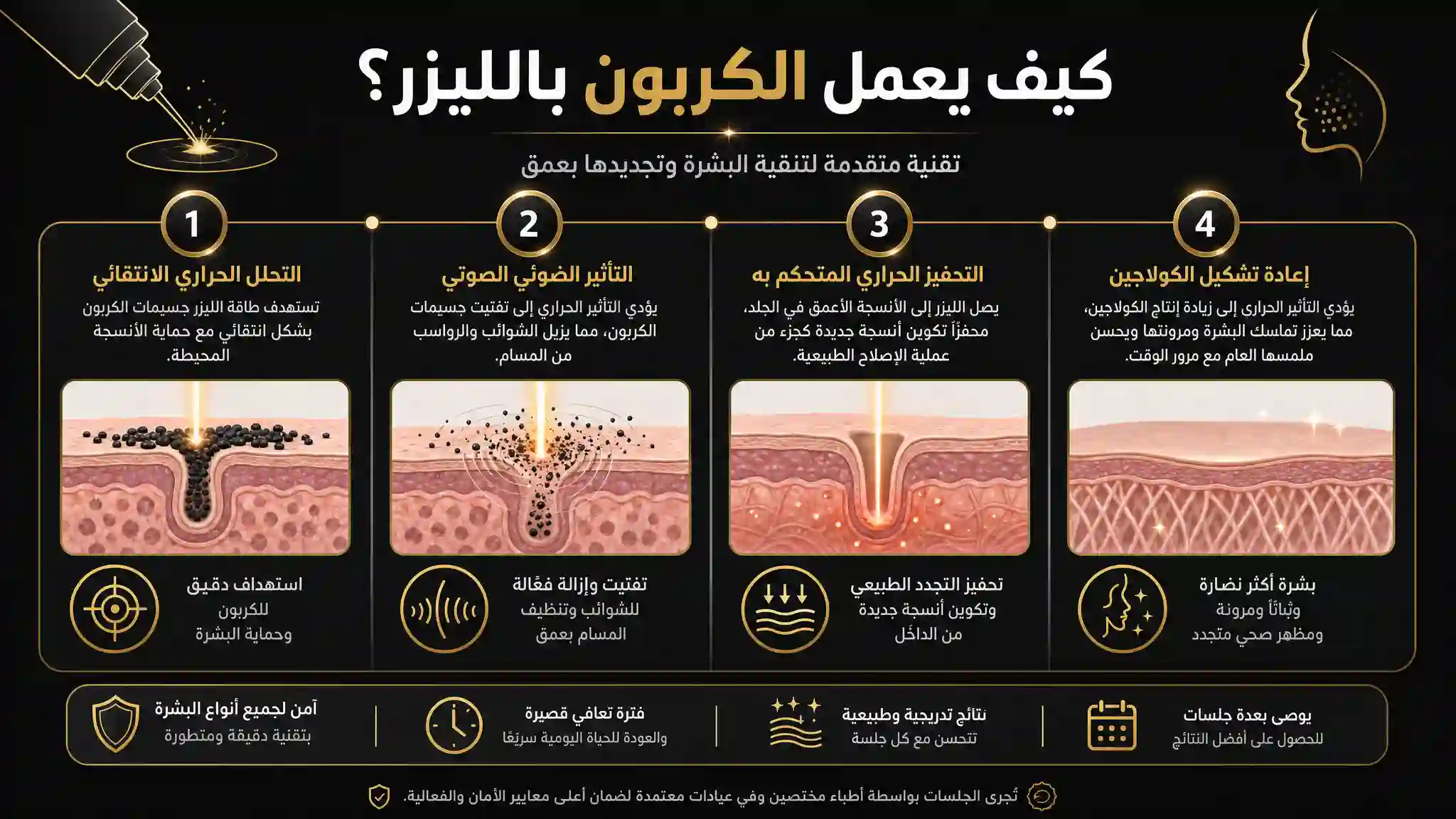 كيف يعمل الكربون بالليزر؟