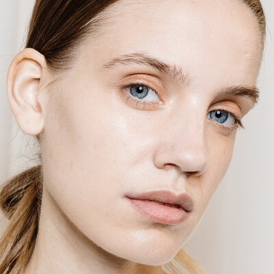 Acne scar treatment in Dubai & Abu Dhabi