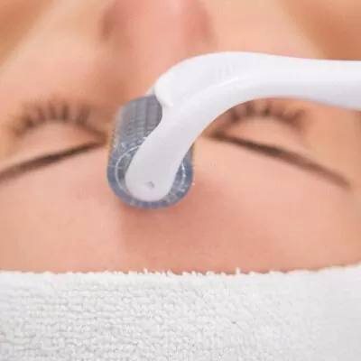 Micro-needling with PRP therapy Dubai & Abu Dhabi