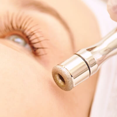 Microdermabrasion in Dubai & Abu Dhabi