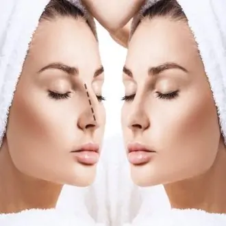 Rhinoplasty Cost in Dubai UAE
