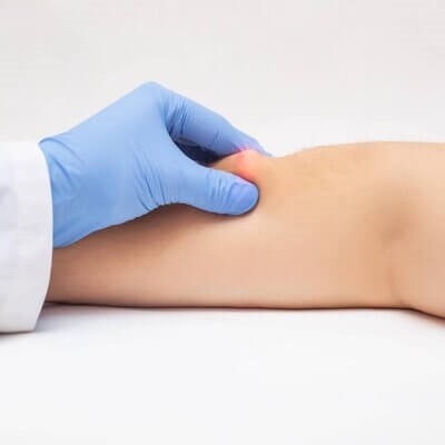 Best Lipoma Treatment in Dubai, Abu Dhabi