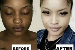 TAD Glutathione Injections In Dubai & Abu Dhabi