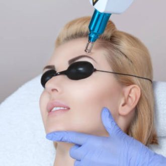 Eyebrow Tattoo Removal