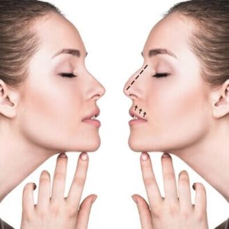 Rhinoplasty Cost in Dubai UAE
