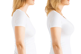 Best Clinic of Fat Transfer Breast Augmentation Cost Dubai