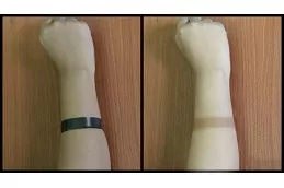 Best Tan Removal Treatment Clinic in Dubai & Abu Dhabi