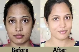 Best Tan Removal Treatment in Abu Dhabi