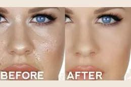 Best Tan Removal Treatment in Dubai