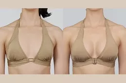 Breast Augmentation Abu Dhabi