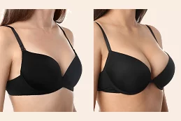 Breast Augmentation in Dubai & Abu Dhabi
