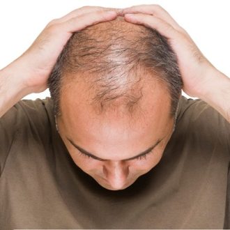 Finasteride for Hair Loss in Dubai UAE