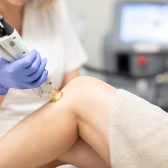 Full Body Laser Hair Removal Cost in Dubai