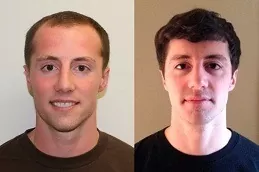 Hair Replacement in Dubai