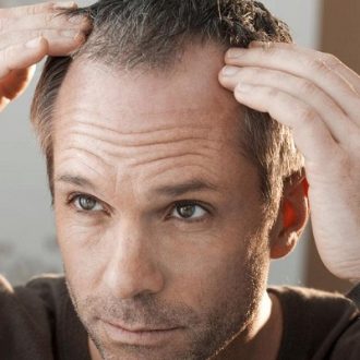 Hair Transplant for Forehead Reduction
