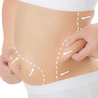 Lipomatic Treatment in Dubai, Abu Dhabi & Sharjah Lipomatic Cost