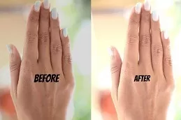 Tan Removal Treatment in Abu Dhabi