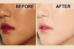 Tan Removal Treatment in Dubai & Abu Dhabi