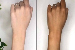 Tan Removal Treatment in Dubai