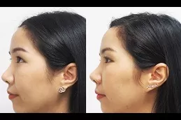 Alarplasty Clinic in Dubai & Abu dhabi