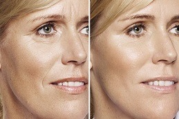 Aquagold Fine Touch Facial Clinic Dubai