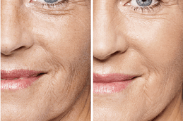 Aquagold Fine Touch Facial Clinic in Abu Dhabi
