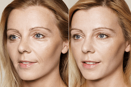 Aquagold Fine Touch Facial Dubai & Abu Dhabi