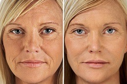 Aquagold Fine Touch Facial Dubai