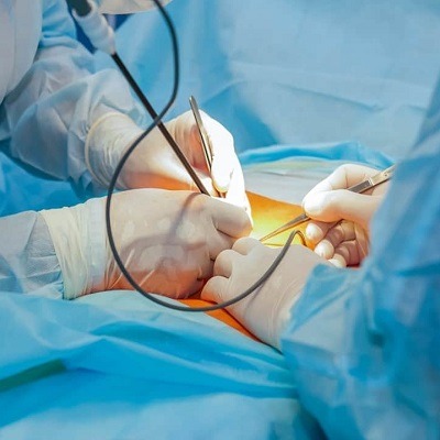 Best Laparoscopic Surgery in Dubai & Abu Dhabi Laparoscopic Cost