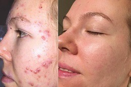 DMK Enzyme Therapy Clinic Dubai & Abu Dhabi