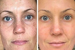 DMK Enzyme Therapy Clinic in Dubai