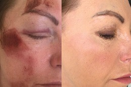 DMK Enzyme Therapy Dubai & Abu Dhabi