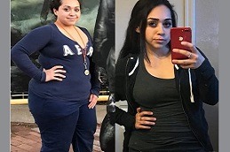 Gastric Bypass Dubai & Abu Dhabi