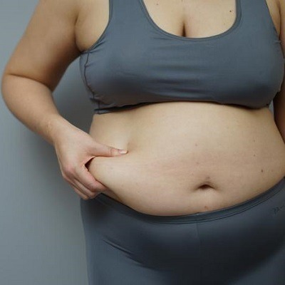 Gastric Bypass in Dubai & Abu Dhabi Mini Gastric Bypass Price