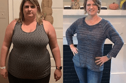 Gastric Bypass in Dubai