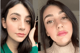 Lip Enlargement in Abu Dhabi