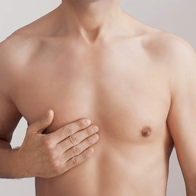 Lipo Chest Surgery in Dubai, Abu Dhabi & Sharjah Thoracic Surgery Dubai