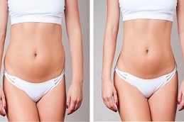 Lipolysis Treatment in Dubai