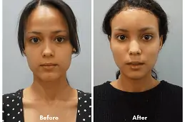 Make Over Cosmetic Surgery Clinic in Abu Dhabi