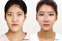 Make Over Cosmetic Surgery Dubai