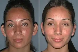 Make Over Cosmetic Surgery in Abu Dhabi